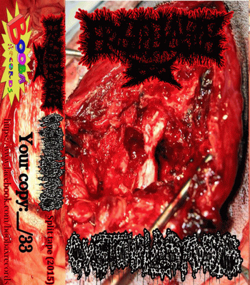 Cystoblastosis : Cystoblastosis - Erysipelasis